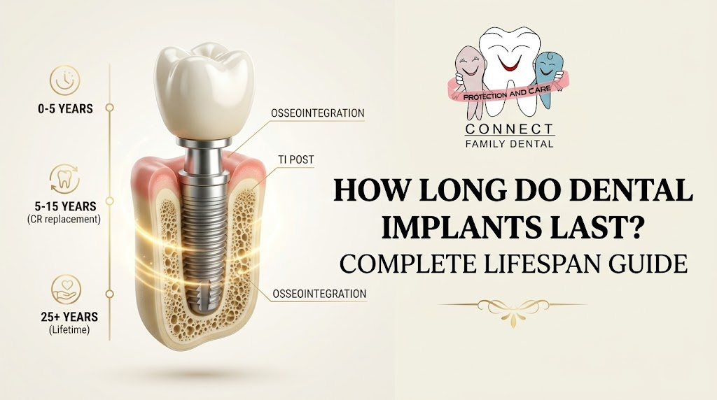 How Long Do Dental Implants Last? Complete Lifespan Guide 2026?