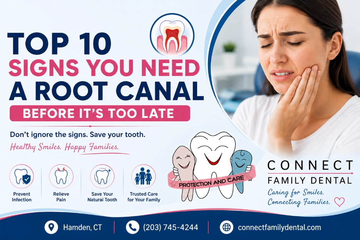 Top 10 Signs You Need a Root Canal Before It's Too Late