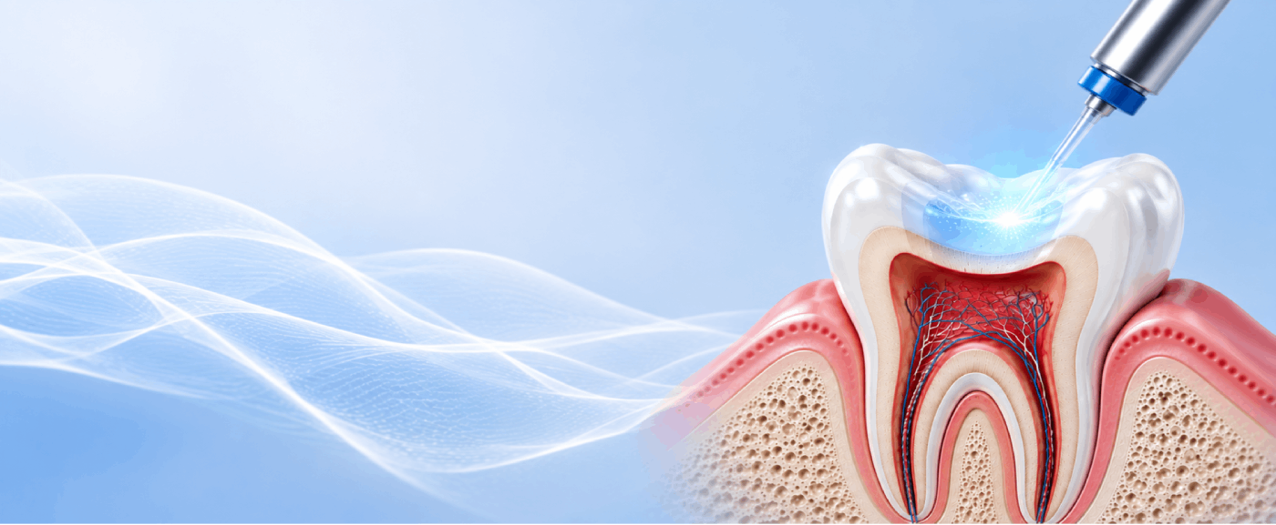 Safe, fast, and effective laser teeth whitening at Connect Family Dental