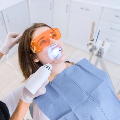 Laser Teeth Whitening Procedure