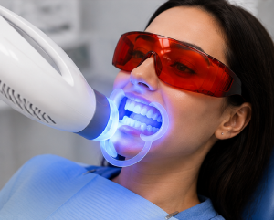 Laser Teeth Whitening Treatment